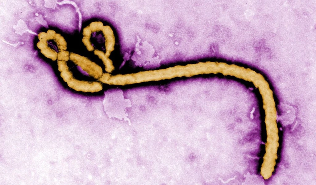 Ebola virus
